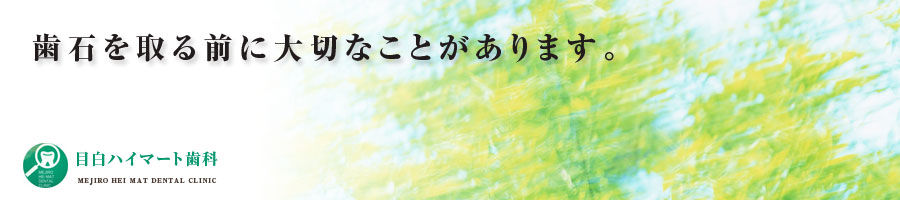 歯石を取る前に大切なことがあります。